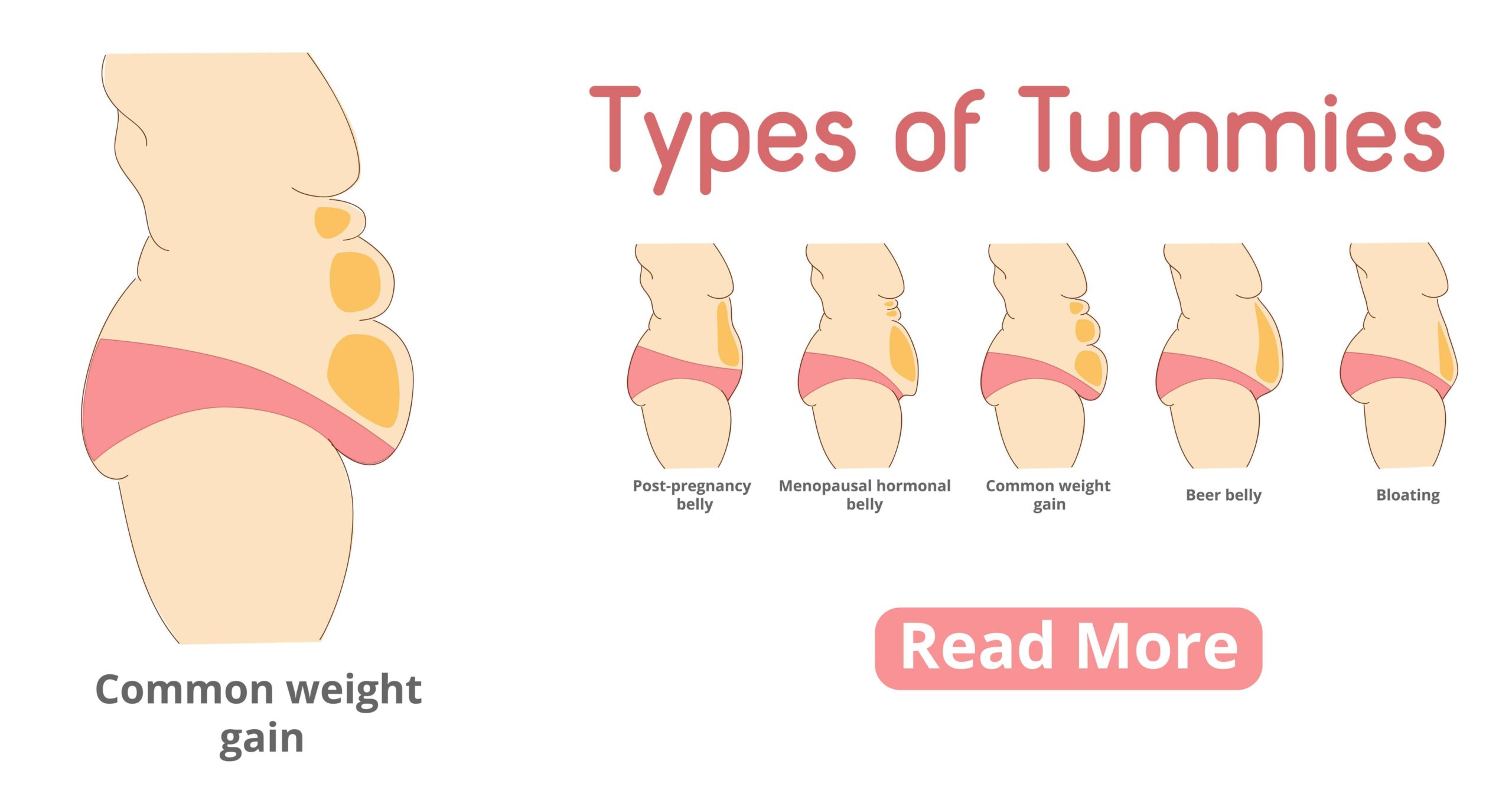 Illustration of different types of tummies.